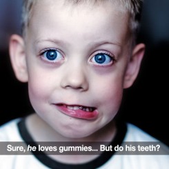 Gummy Vitamins May Not Be Good For Your Child’s Teeth