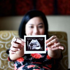 How Pregnancy Affects Your Oral Health