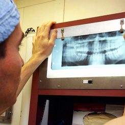 Photo Op: Types Of Dental X-Rays