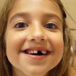 Baby Teeth Folklore Around The World