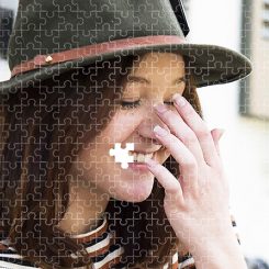 Congenitally Missing Teeth