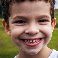 Is Your Frenulum Holding You Back?