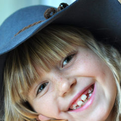 Why Are Dental Sealants Important?