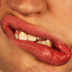 Bleeding Gums: Causes and Treatment