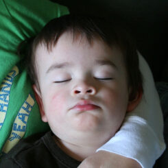 Snoring, Sleep Apnea, and Teeth